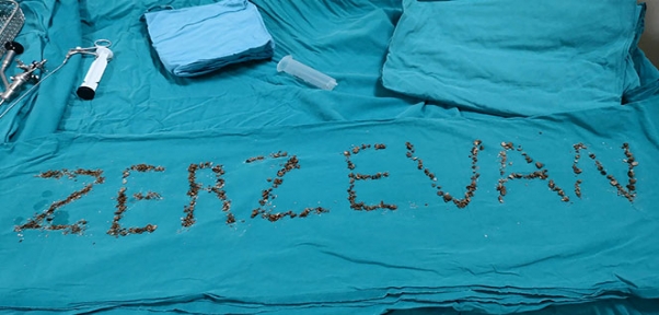 Böbreğinden `Zerzevan` Çıktı