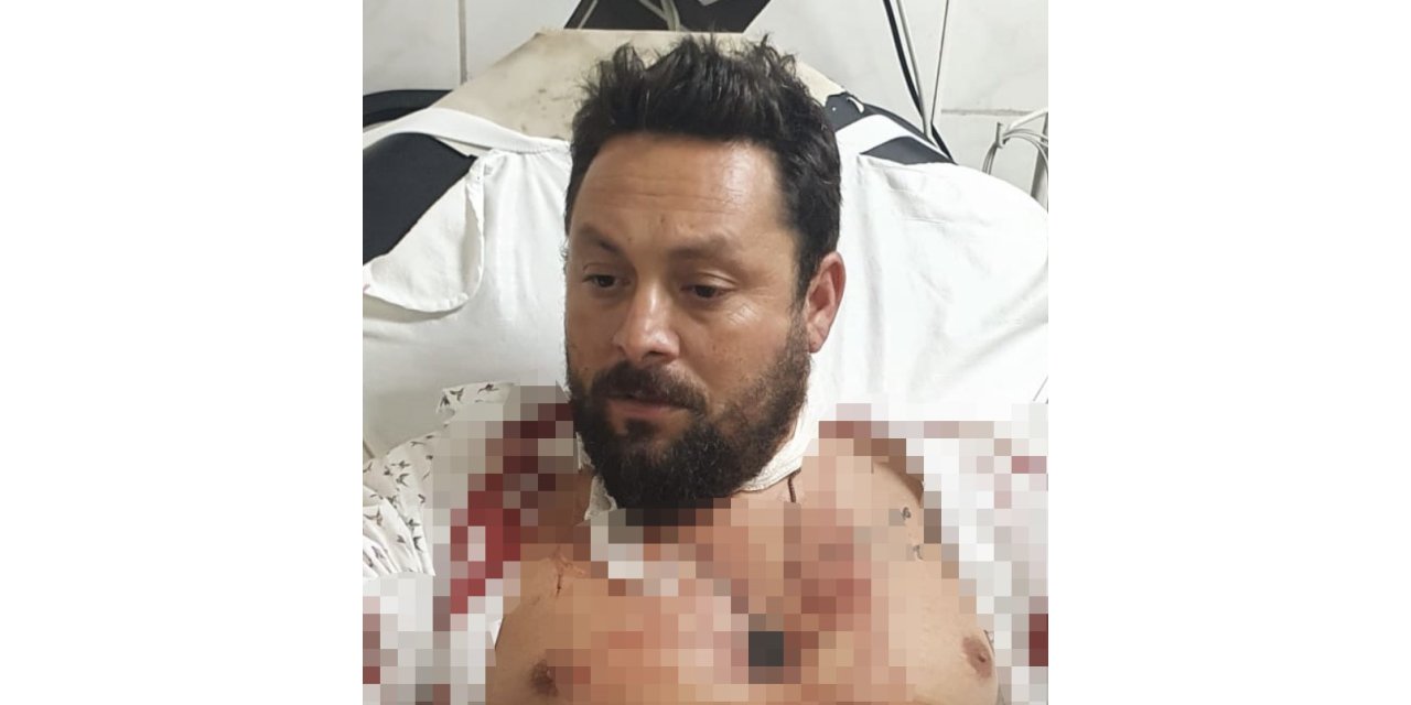 İki arkadaşa eş zamanlı silahlı saldırı: 1 ağır 2 yaralı
