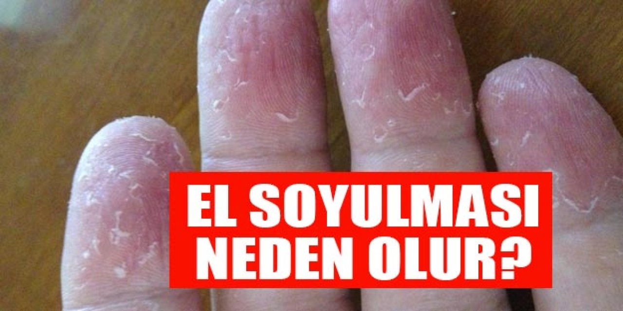 Eldeki Soyulmaların Nedeni! Mutlaka Aklınızda Bulunması Gereken Uyarılar