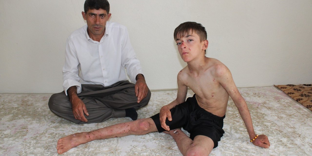 Hakkarili Ammar'ın tek hayali iyileşip arkadaşları ile futbol oynamak