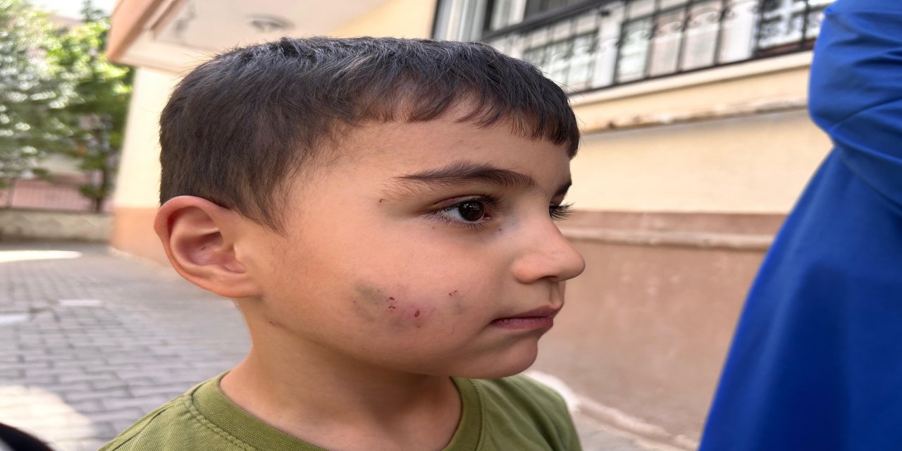 Evde uyurken lağım faresi saldırdı! Aile dehşeti anlattı: "Oğlumun yüzünden kanlar akıyordu"