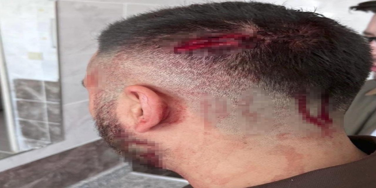 Okulda Dehşet! Öğretmene Sopayla Saldırdı