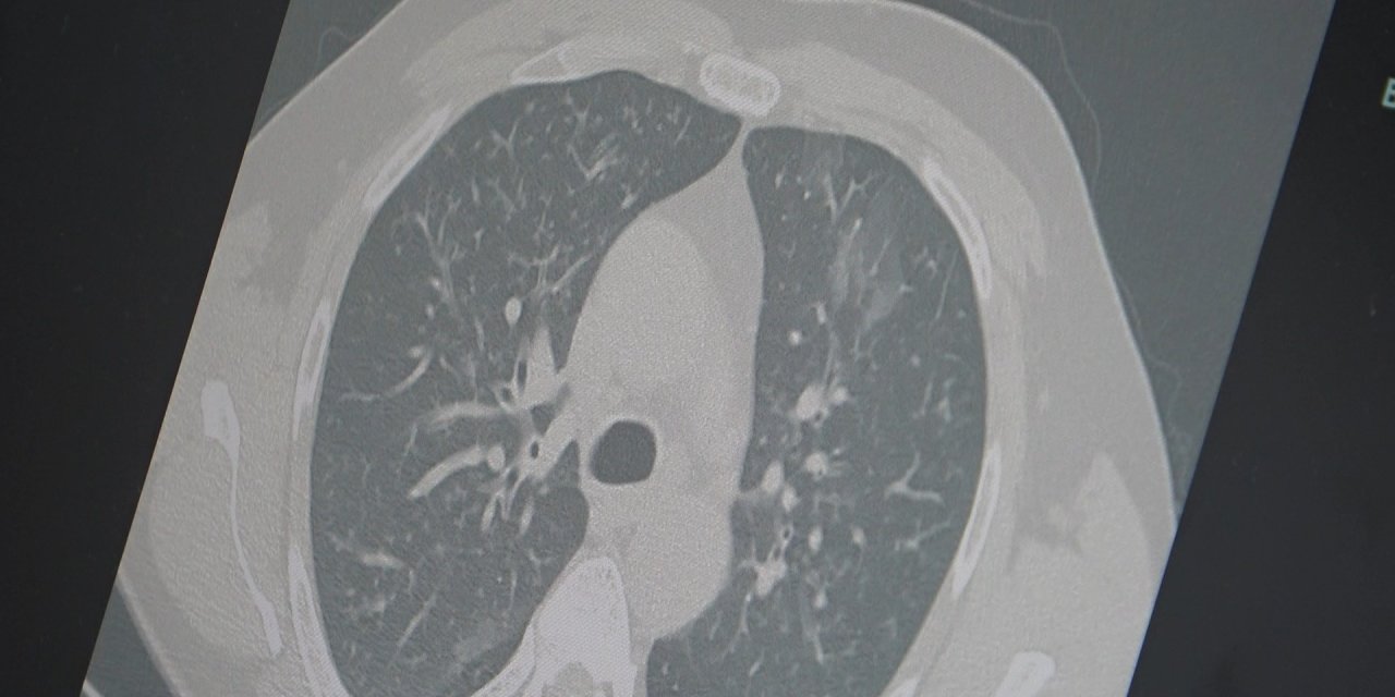 3’lü salgın Türkiye'de görüldü, Profesörden uyarı gecikmedi