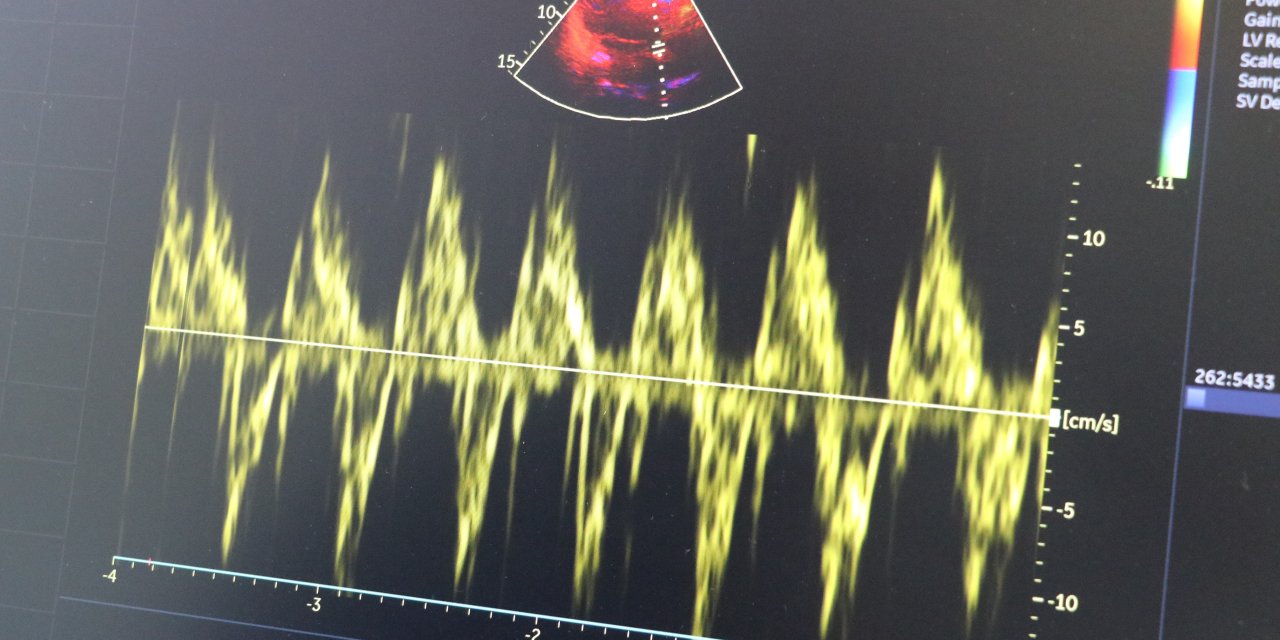 "Kalp hastaları soğuk havada daha dikkatli olmalı"