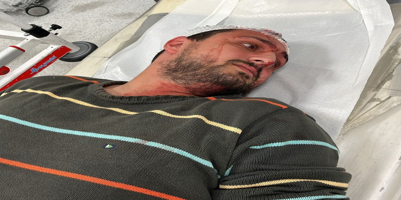 Otizmli Gence İnsanlık Dışı Saldırı: Kafasına 6 Dikiş Atıldı!