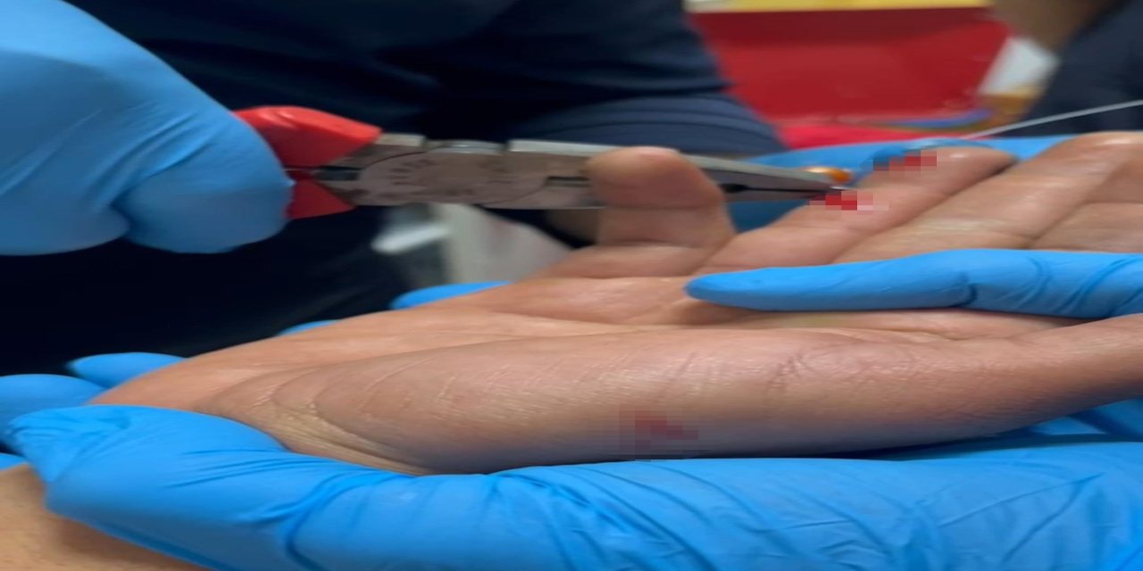 Balık Avı Acı Bitti: Oltayı Atarken İğne Parmağına Saplandı