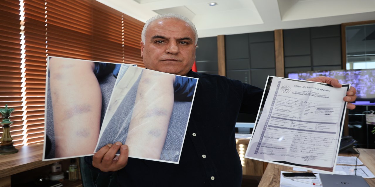 Diyarbakır’da Öğrenciye Şiddet İddiası Tartışma Yarattı