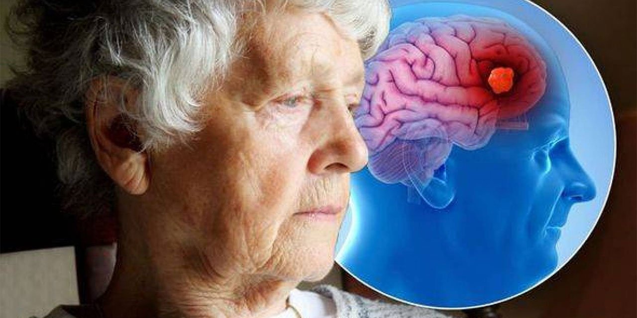 Yeni bir dil öğrenmek demans riskini yüzde 40 azaltabilir