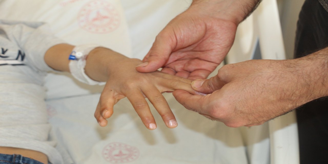 Şırnak’ta Yapışık Parmaklı İki Kardeş Ameliyatla Sağlığına Kavuştu