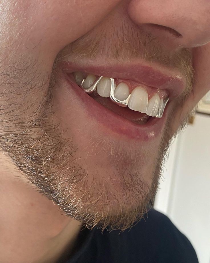 Erkeklerde diş estetiğinde yeni moda: Grillz