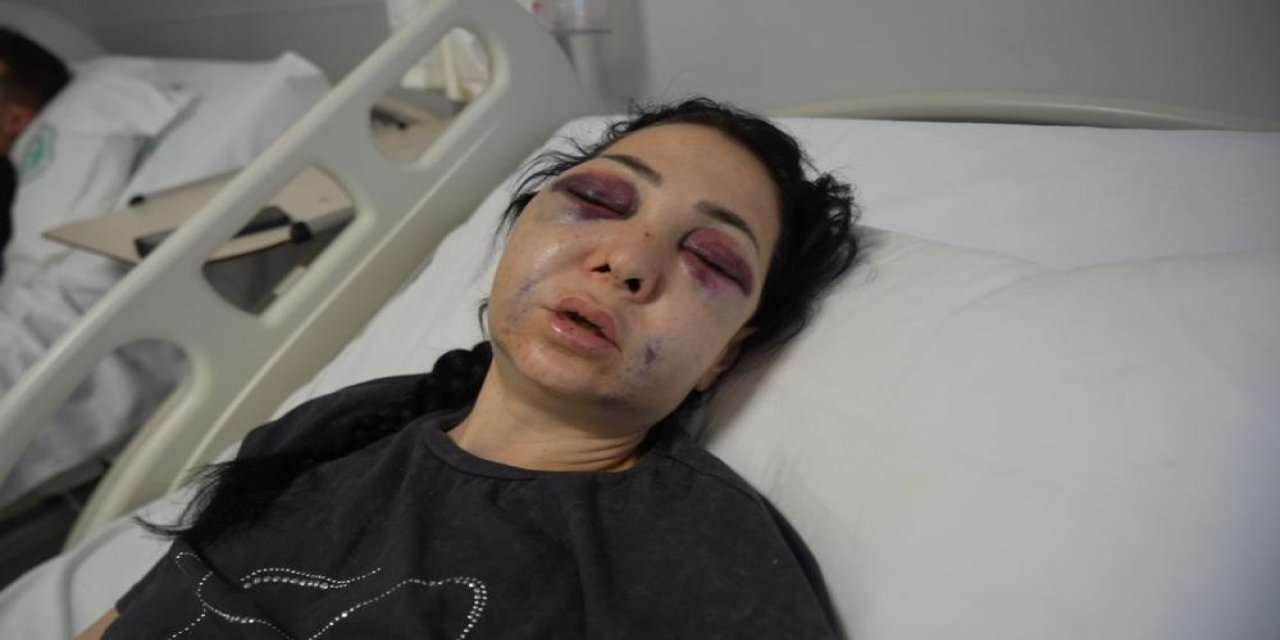 2. Kafede Bayram Günü Vahşet: Anne Ağır Yaralandı, Oğlu Kanlar İçinde Taşıdı