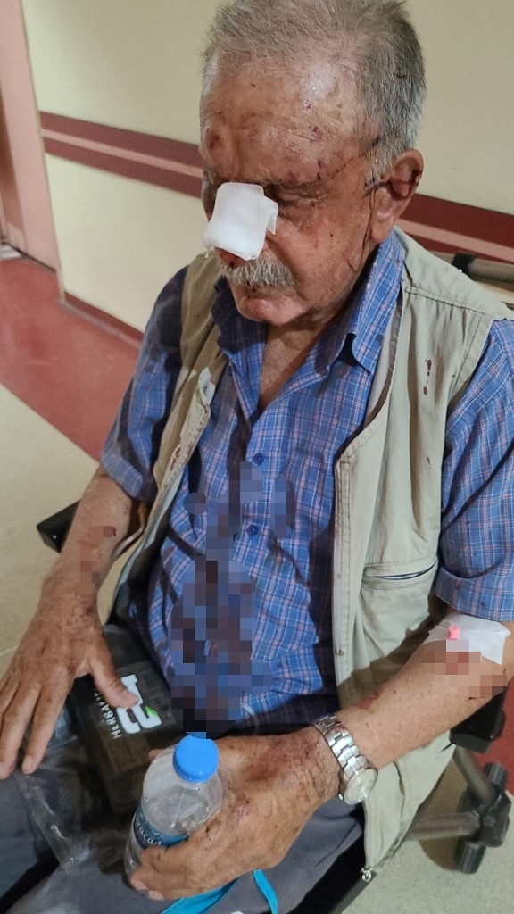 Miras davası yüzünden darp edilen yaşlı çift yaşam savaşı veriyor