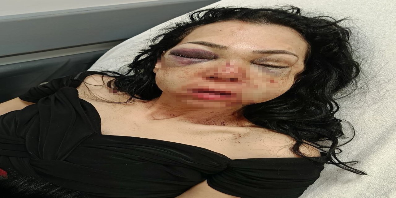 Anne ve oğlunun darbedildiği kafedeki dehşetin ilk duruşması görüldü