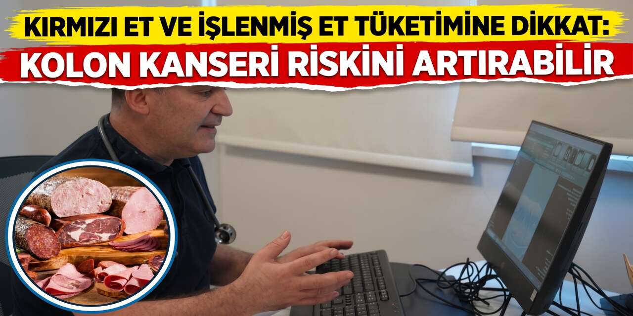 Kırmızı Et ve İşlenmiş Et Tüketimine Dikkat: Kolon Kanseri Riskini Artırabilir