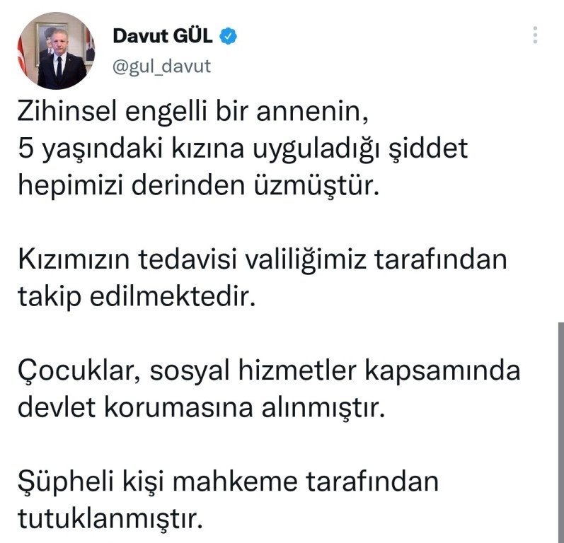 Gaziantep'te 5 yaşındaki kızına işkence eden zihinsel engelli anne tutuklandı  