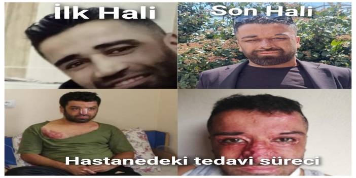 Şırnak’ta Tek Başına Yaşayan Epilepsi Hastası Yardım Bekliyor