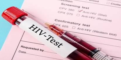 Şırnak Devlet Hastanesi'nde HIV enfeksiyonu Takibi Başladı