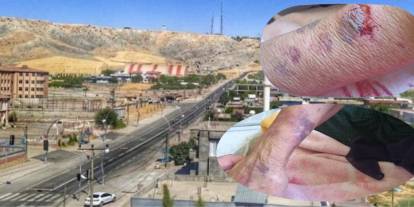 Şırnak’ta 81 Yaşındaki Kadına Üvey Oğlundan Şiddet!