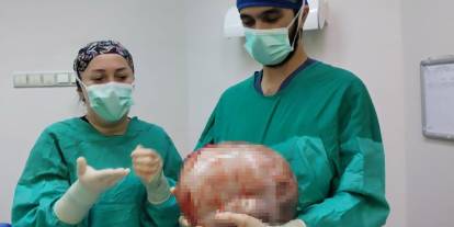 Karnı 2 ayda 9 aylık hamile gibi büyüdü, içinden karpuz kadar kitle çıktı