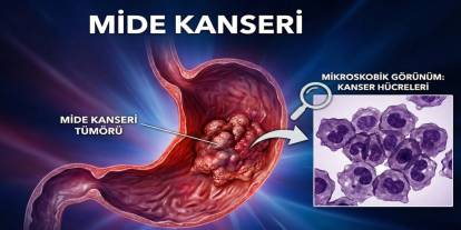 "Strestendir" Diyerek Geçiştirmeyin! Midenizin Sesine Kulak Verin