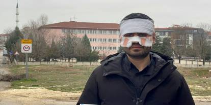 Okul Koridorunda Akılalmaz Olay! "Şaka" Diye Başladı, Kaynar Çaylı Saldırıyla Bitti