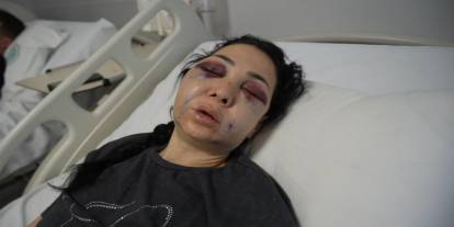 2. Kafede Bayram Günü Vahşet: Anne Ağır Yaralandı, Oğlu Kanlar İçinde Taşıdı