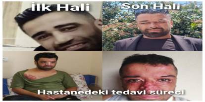 Şırnak’ta Tek Başına Yaşayan Epilepsi Hastası Yardım Bekliyor