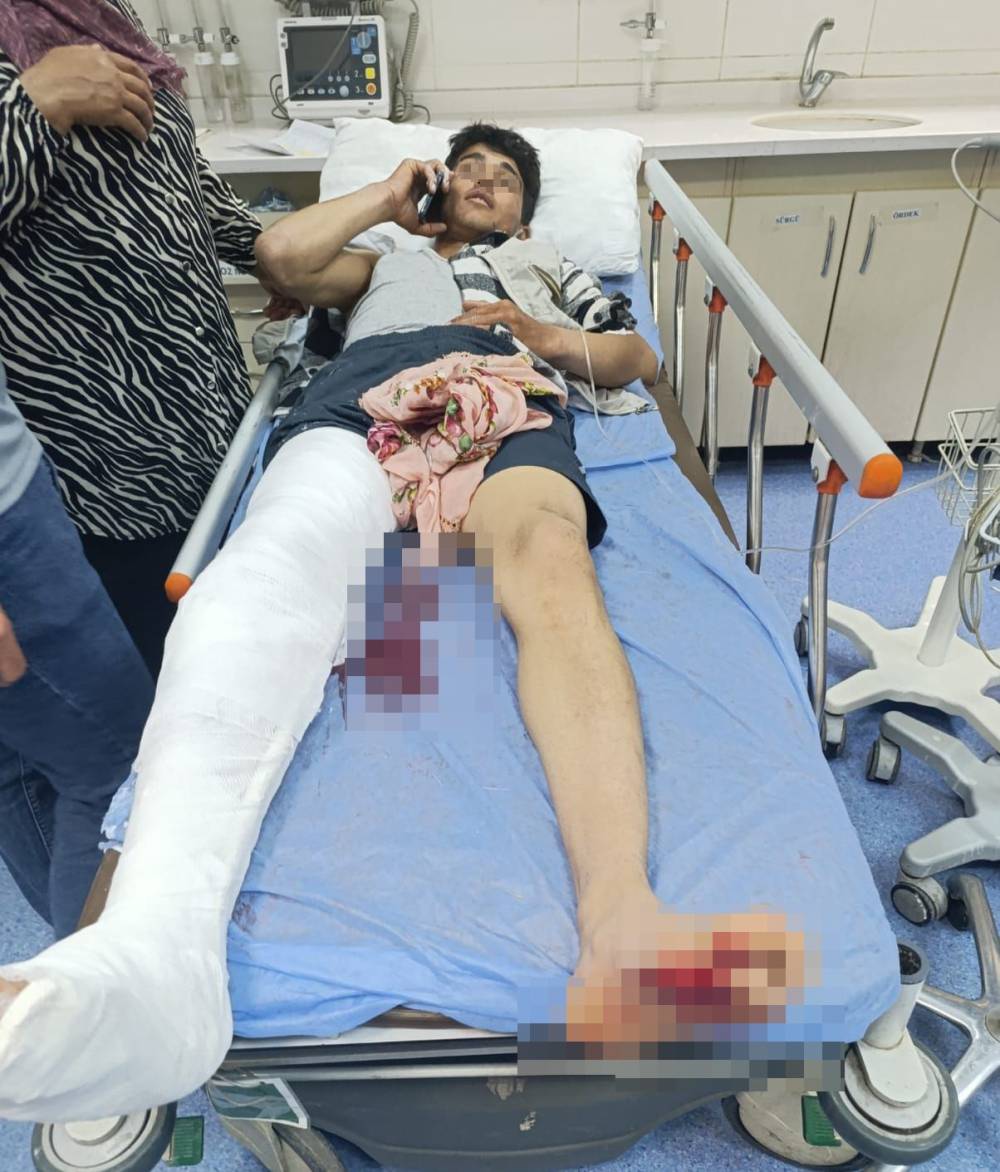 Muş’ta ayının saldırdığı çocuk yaralandı